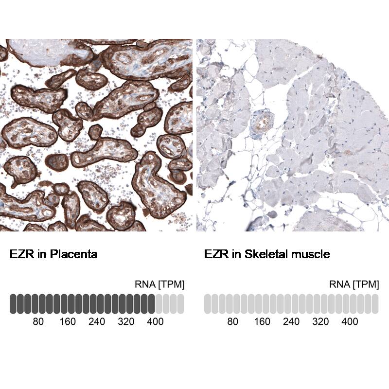 Analysis in human placenta and skeletal muscle tissues using NBP3-44476 antibody. Corresponding Ezrin RNA-seq data are presented for the same tissues.