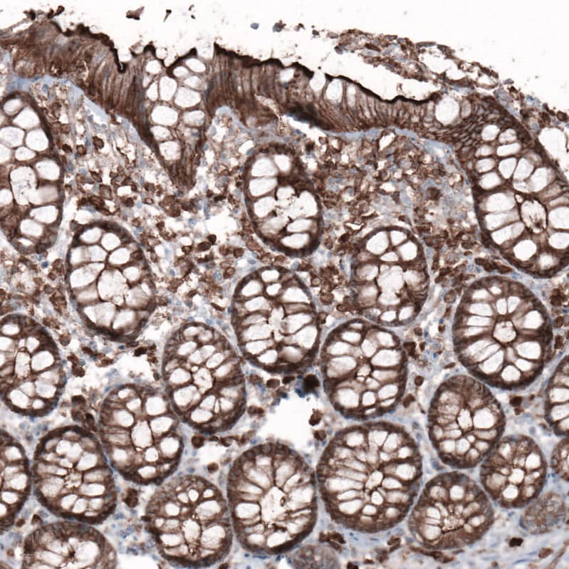 Staining of human rectum shows strong membranous positivity in glandular cells.