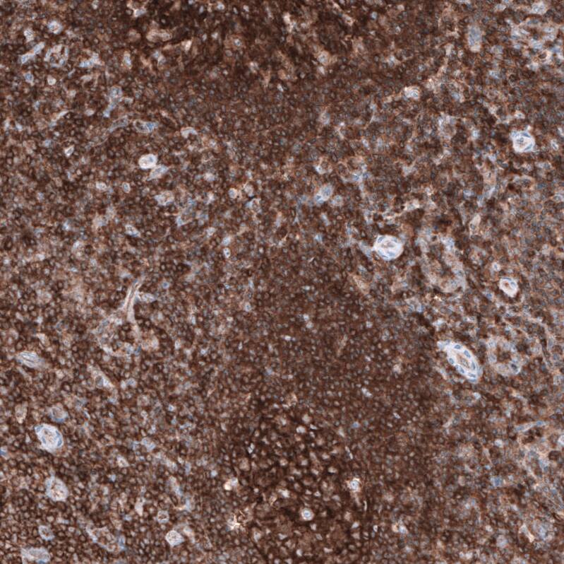 Staining of human tonsil shows strong membranous positivity in non-germinal center cells.