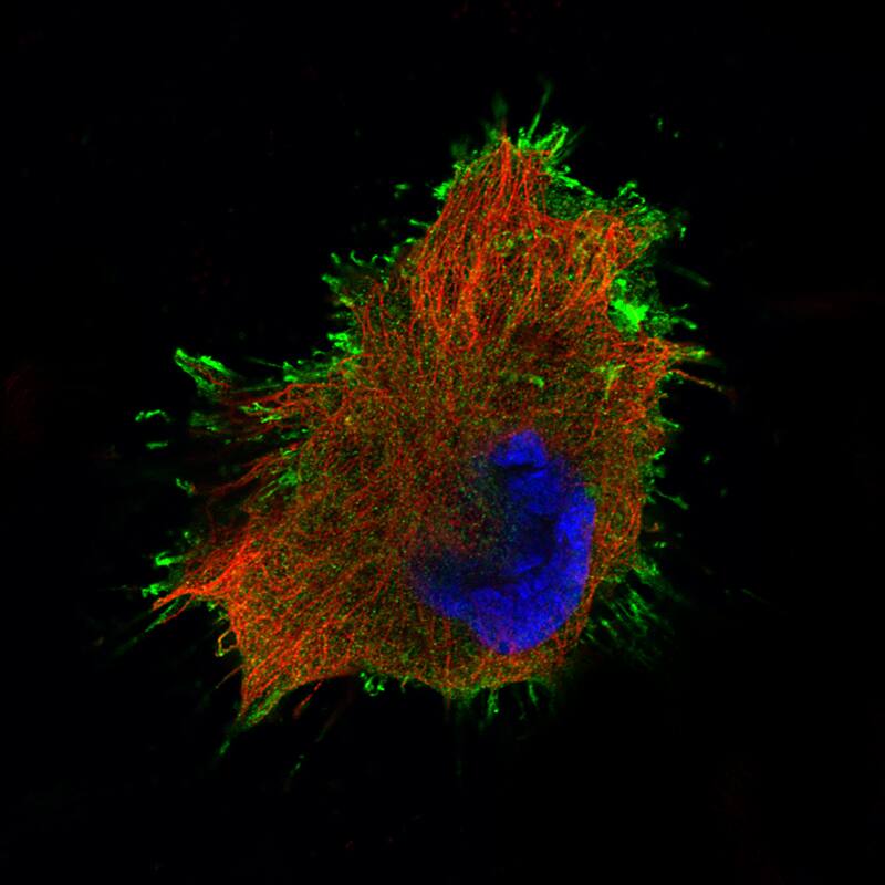 Staining of U-251 cells using the Anti-Ezrin monoclonal antibody) .