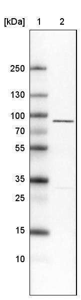 Lane 1: Marker [kDa]Lane 2: Human cell line U-251 MG