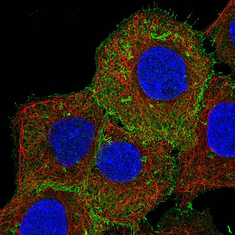 Staining of A-431 cells using the Anti-Ezrin monoclonal antibody) .