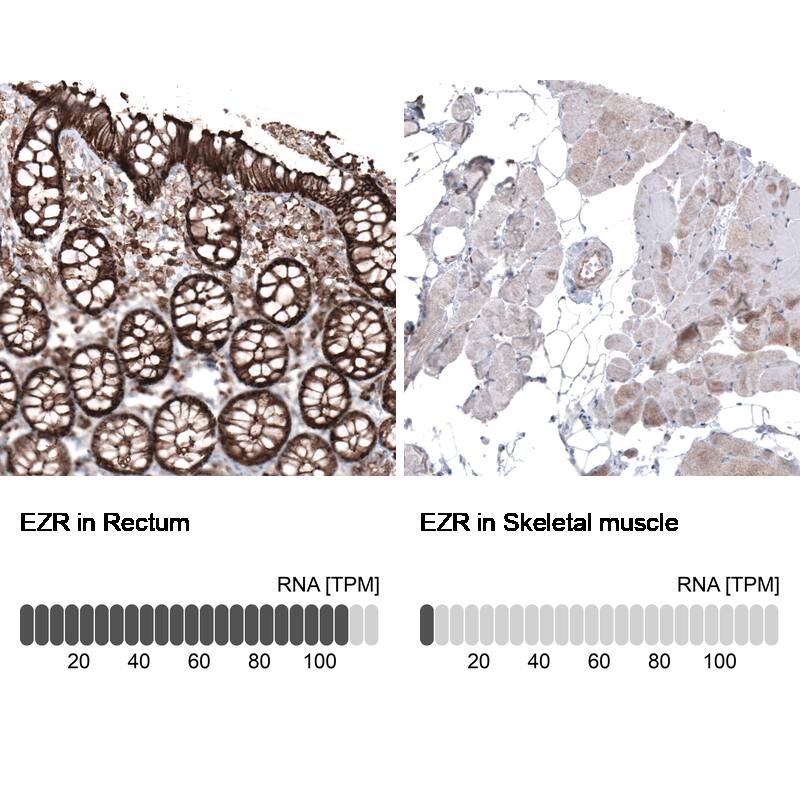 Analysis in human rectum and skeletal muscle tissues using NBP3-44477 antibody. Corresponding Ezrin RNA-seq data are presented for the same tissues.