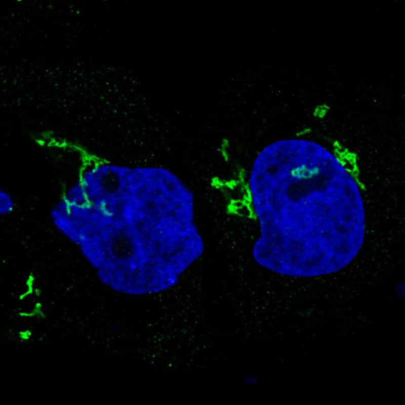 Staining in A431 cell line with Anti-GRASP55 monoclonal antibody) .