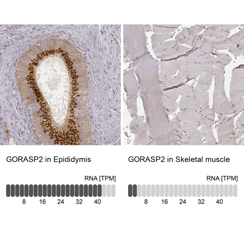 Analysis in human epididymis and skeletal muscle tissues using NBP3-44478 antibody. Corresponding GRASP55 RNA-seq data are presented for the same tissues.
