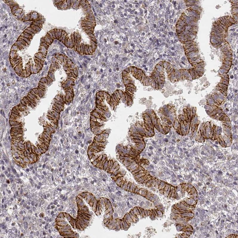 Staining of human endometrium shows moderate to strong membranous and granular cytoplasmic positivity in glandular cells.