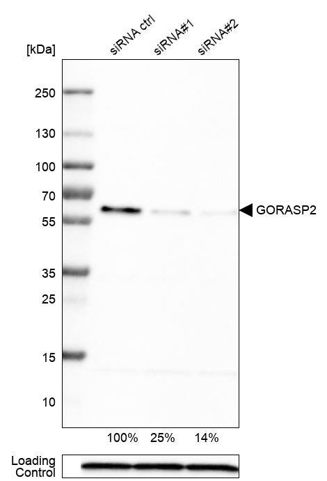 Analysis in U-251MG cells transfected with control siRNA, target specific siRNA probe #1 and #2, using Anti-GRASP55 antibody. Remaining relative intensity is presented. Loading control: Anti-PPIB.