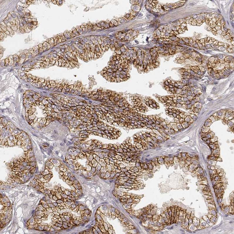 Staining of human prostate shows moderate to strong membranous and granular cytoplasmic positivity in glandular cells.