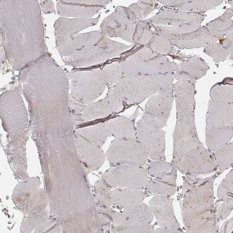 Staining of human skeletal muscle shows no positivity in striated muscle fibers as expected.