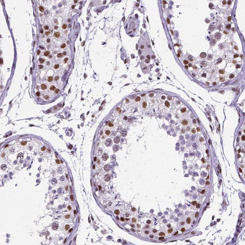 Staining of human testis shows moderate to strong nuclear positivity in cells in seminiferous ducts.