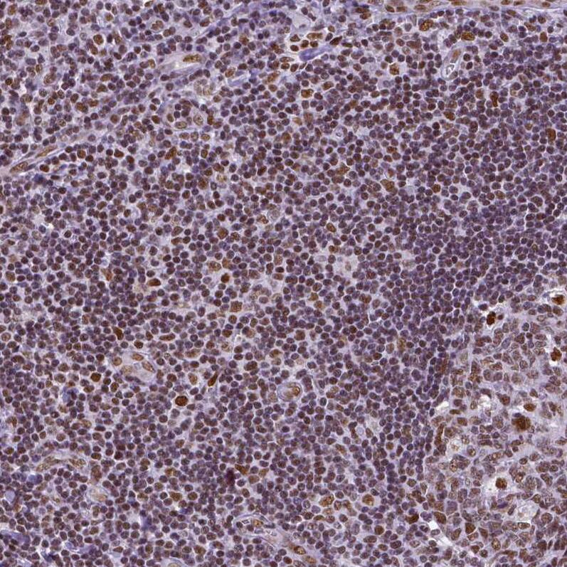 Staining of human tonsil shows moderate to strong nuclear positivity in lymphoid cells.