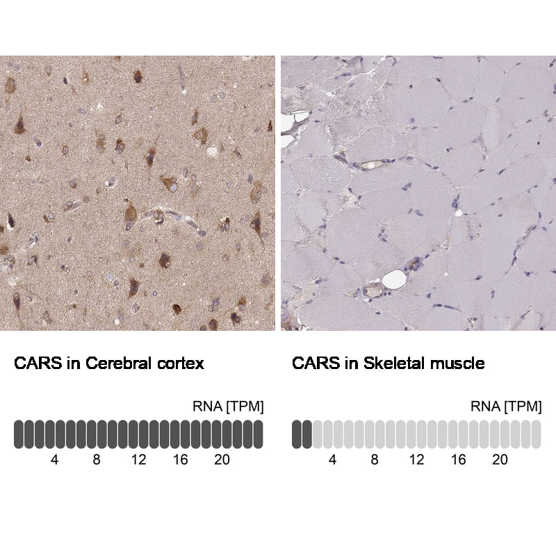 Immunohistochemistry-Paraffin CARS Antibody (CL2302) - Azide and BSA Free