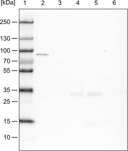 Western Blot CARS Antibody (CL2302) - Azide and BSA Free