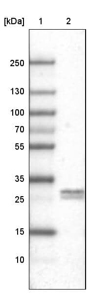Lane 1: Marker [kDa]Lane 2: Human testis tissue lysate