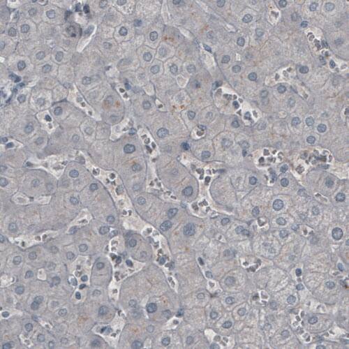 Staining of human liver shows absence of immunoreactivity (negative control).