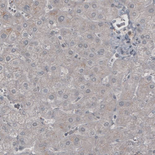 Staining of human liver shows absence of immunoreactivity (negative control).