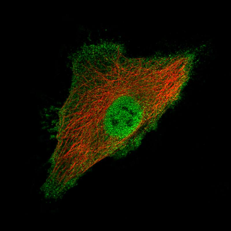 Staining of HeLa cells using the Anti-Ly6K monoclonal antibody) .