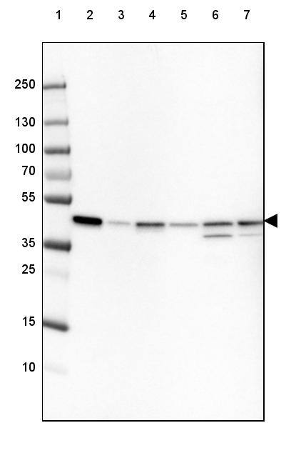 Lane 1: Marker [kDa] 250, 130, 100, 70, 55, 35, 25, 15, 10Lane 2: Human cell line HeLaLane 3: Human cell line HEK 293Lane 4: Human cell line A-431Lane 5: Human cell line HepG2Lane 6: Mouse cell line NIH-3T3Lane 7: Rat cell line NBT-II
