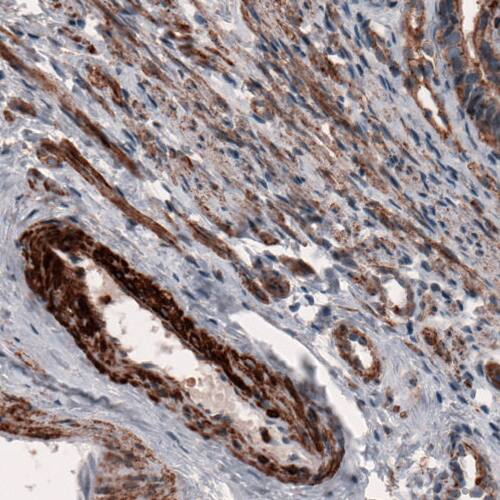 Staining of human fallopian tube shows immunoreactivity in smooth muscle cells of blood vessels and connective tissue.