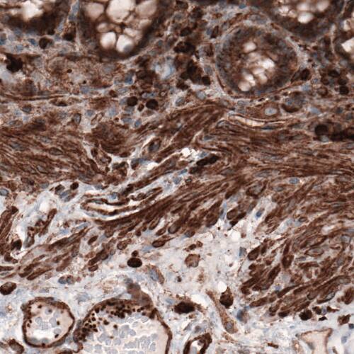 Staining of human colon shows positivity in smooth muscle, lymphoid and glandular cells.
