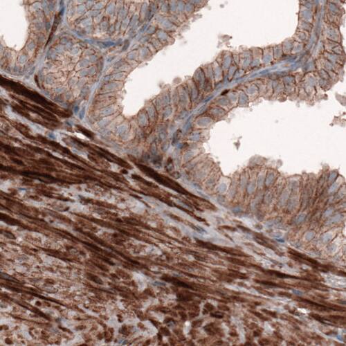 Staining of human prostate shows strong cytoplasmic immunoreactivity in smooth muscle and weak positivity in glandular cells.