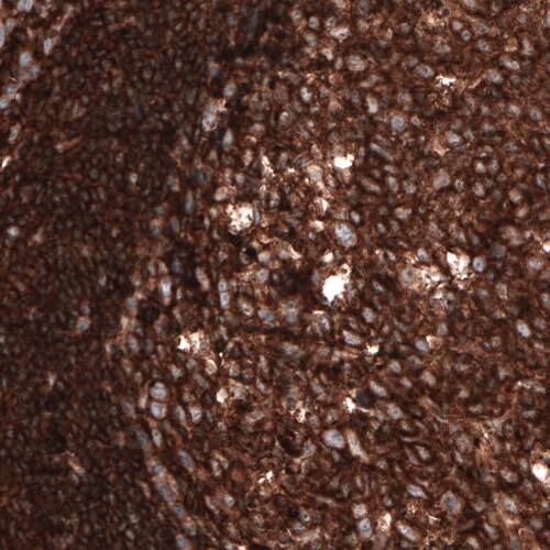 Staining of human tonsil shows strong positivity in lymphoid cells.