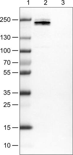Lane 1: Marker [kDa]Lane 2: Human cell line JurkatLane 3: Human cell line MCF-7