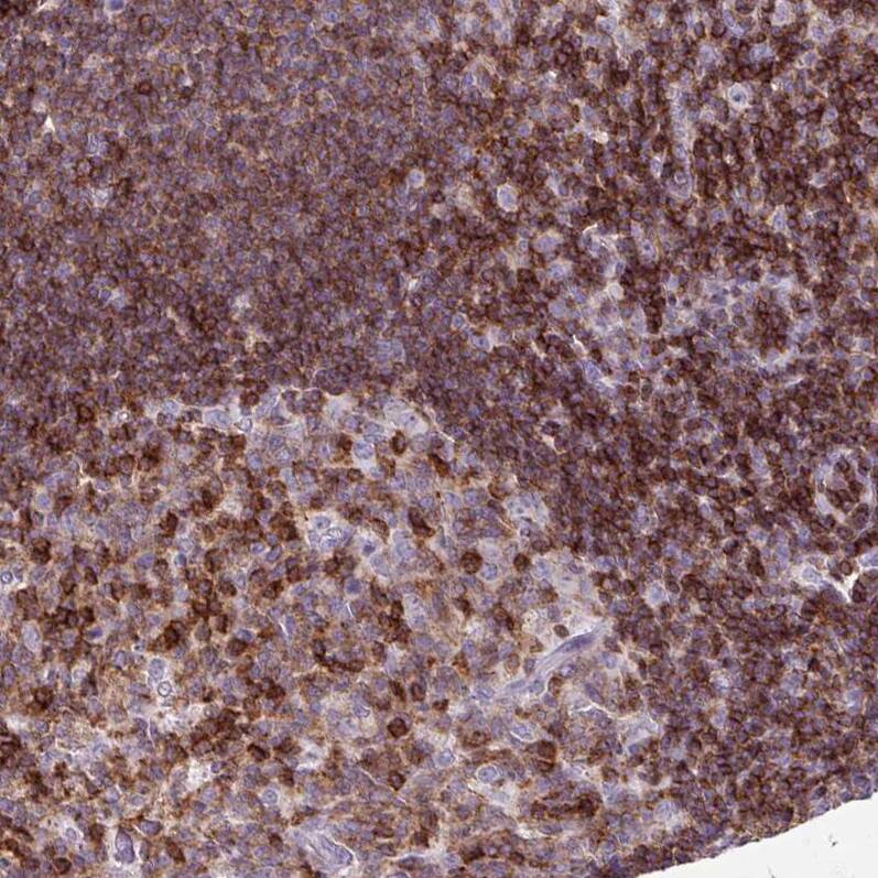 Staining of human lymph node shows moderate to strong membranous positivity in lymphoid cells.