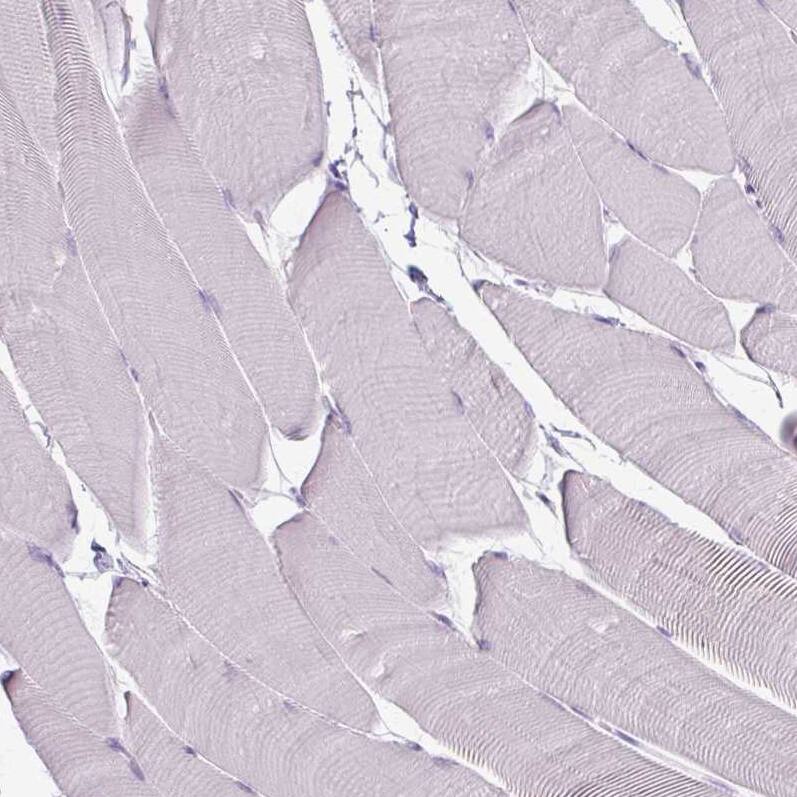 Staining of human skeletal muscle shows no positivity in myocytes as expected.