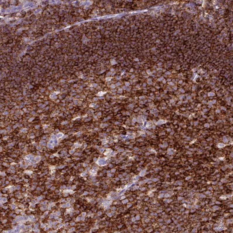 Staining of human tonsil shows strong membranous positivity in lymphoid cells.