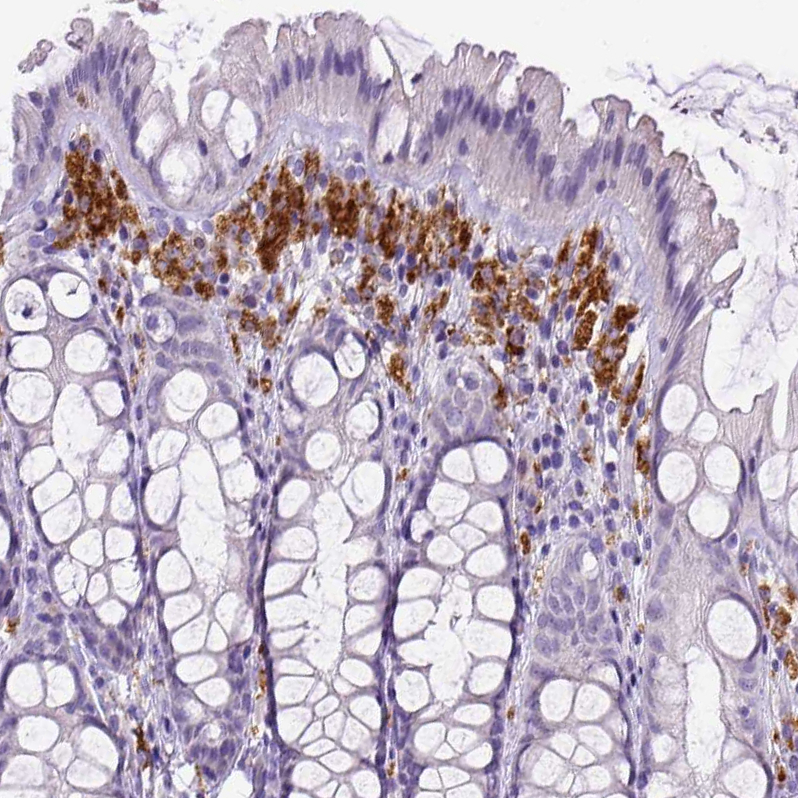 Staining of human colon shows strong cytoplasmic positivity in lymphoid cells.