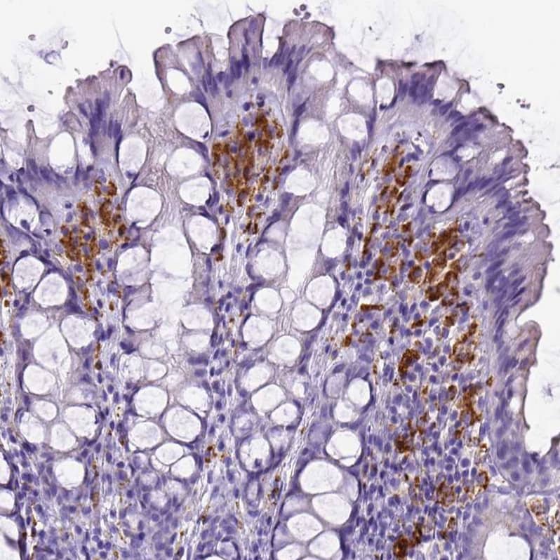 Staining of human colon shows strong cytoplasmic positivity in lymphoid cells.