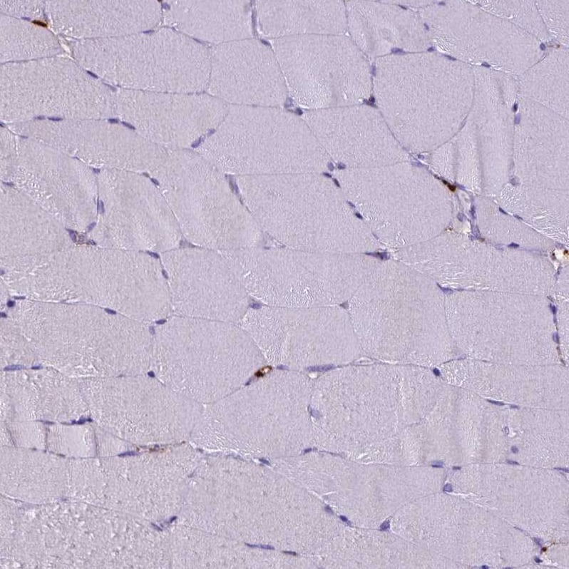 Staining of human skeletal muscle shows no positivity in myocytes as expected.