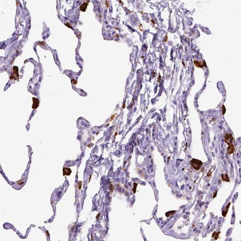Staining of human lung shows strong cytoplasmic positivity in macrophages.
