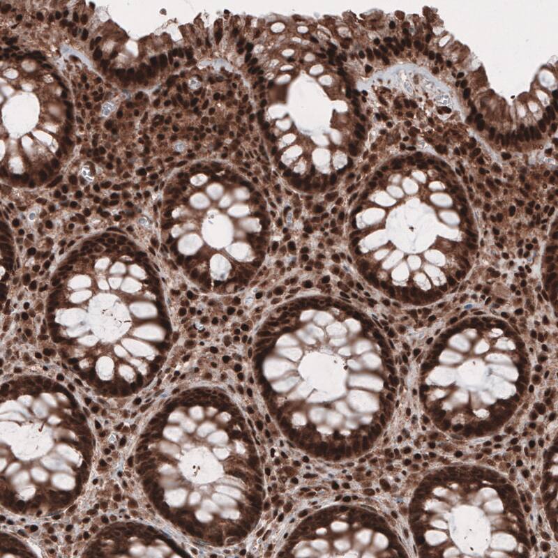 Staining of human rectum shows strong cytoplasmic and nuclear positivity in glandular and connective tissue cells.