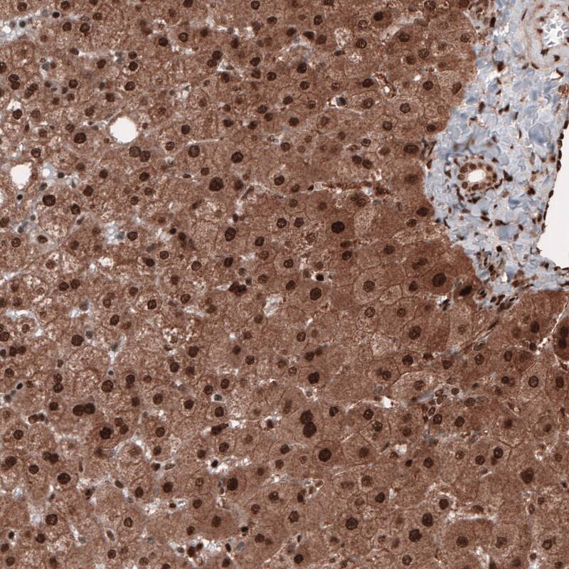 Staining of human liver shows strong cytoplasmic and nuclear immunoreactivity in hepatocytes.
