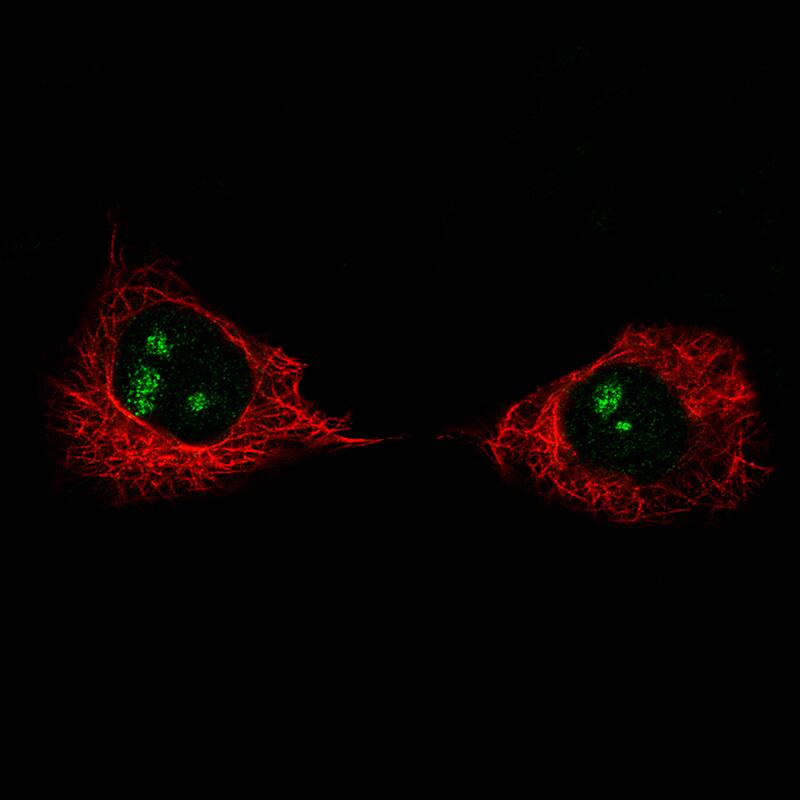 Staining of A-431 cells using the Anti-MK167 monoclonal antibody) .