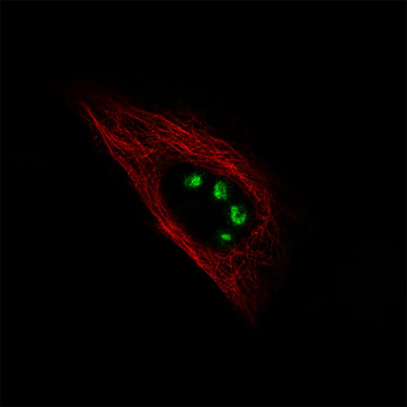 Staining of U-251 cells using the Anti-MK167 monoclonal antibody) .