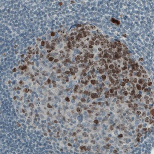 Staining of lymph node in human colon shows strong nuclear and nucleolar immunoreactivity in the reaction centrum cells.