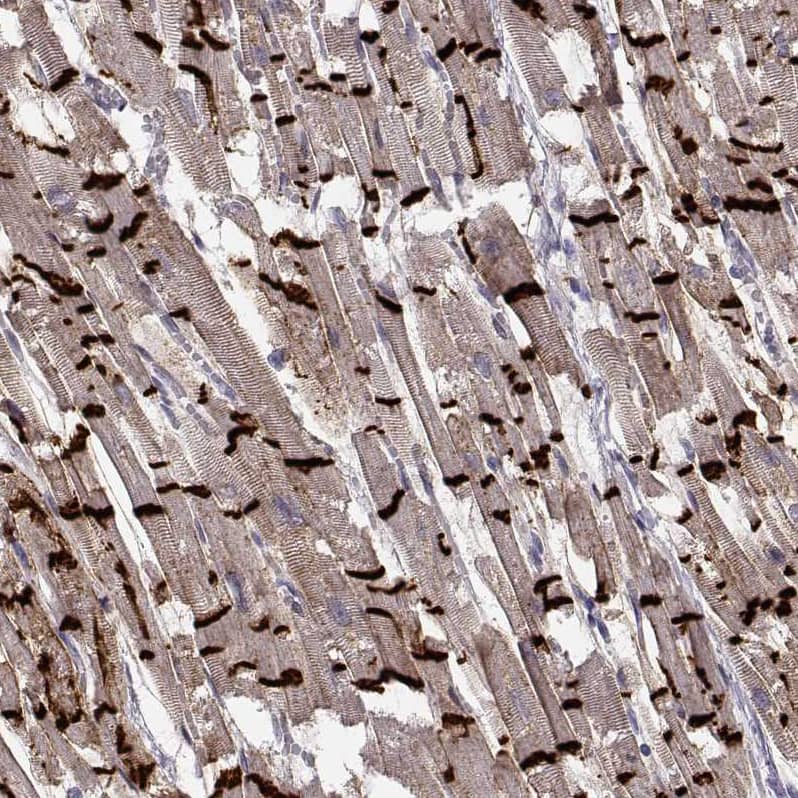 Staining of human heart muscle shows strong positivity in the intercalated discs of cardiomyocytes.