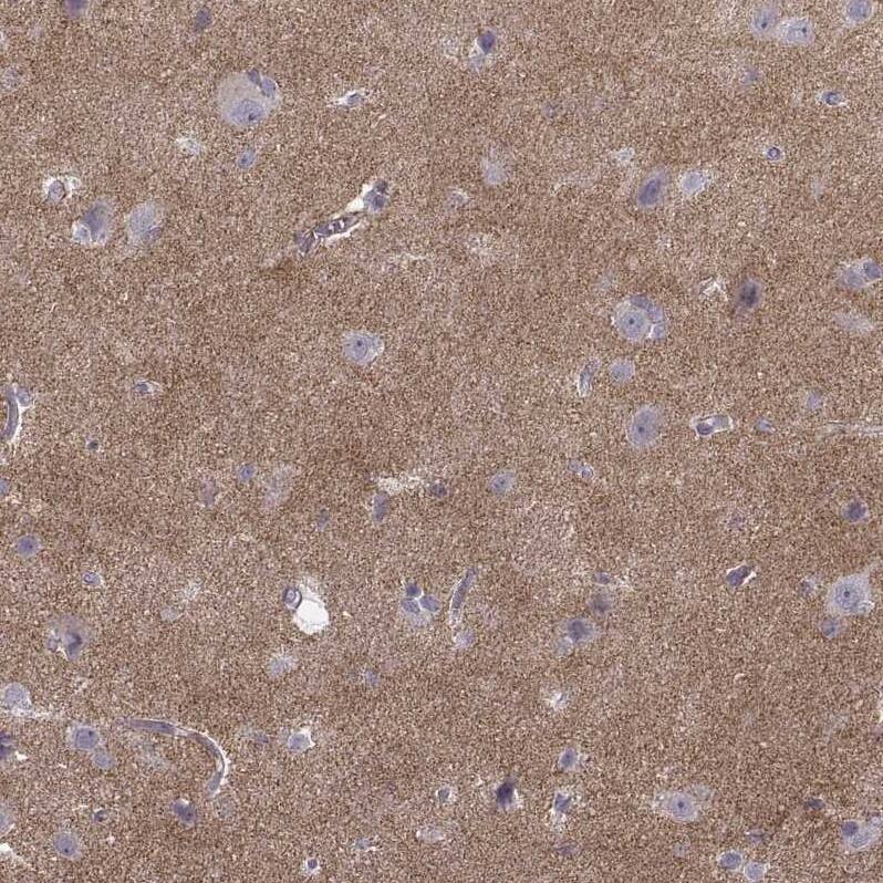Staining of human cerebral cortex shows moderate positivity in neuropil.