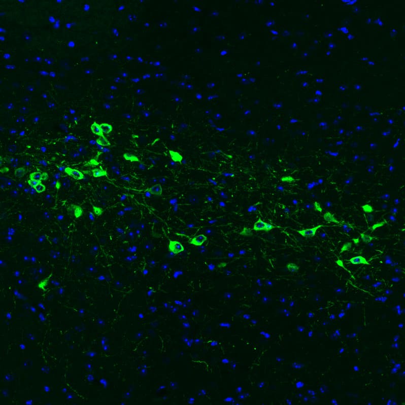Staining of mouse brain shows strong positivity in neurons in the hypothalamus.