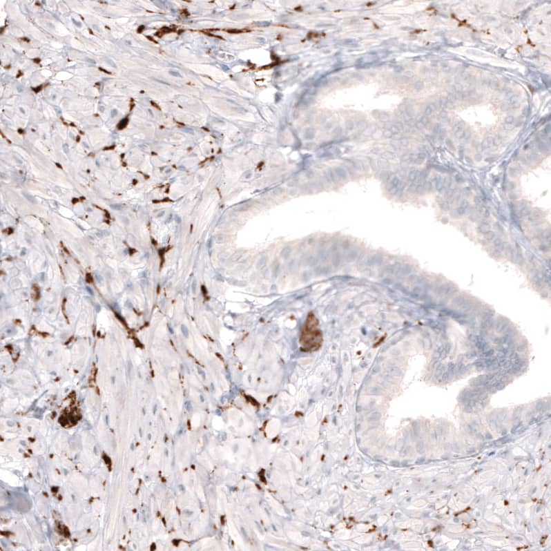 Staining of human prostate shows  strong positivity in sympathetic peripheral nerves.