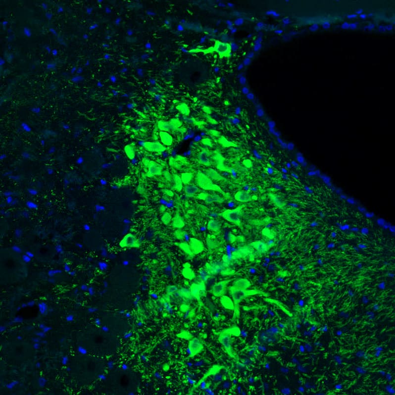 Staining of rat locus coeruleus shows strong positivity in noradrenergic neurons.