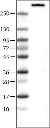 Lane 1: Marker [kDa]  Lane 2: Human cell line U-251 MG