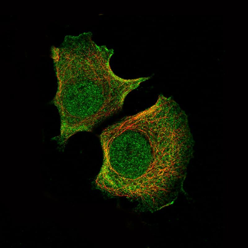 Staining of MCF7 cells using the Anti-AKT1 monoclonal antibody) .