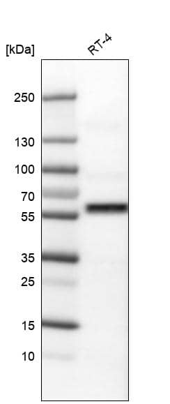 Analysis in human cell line RT-4.