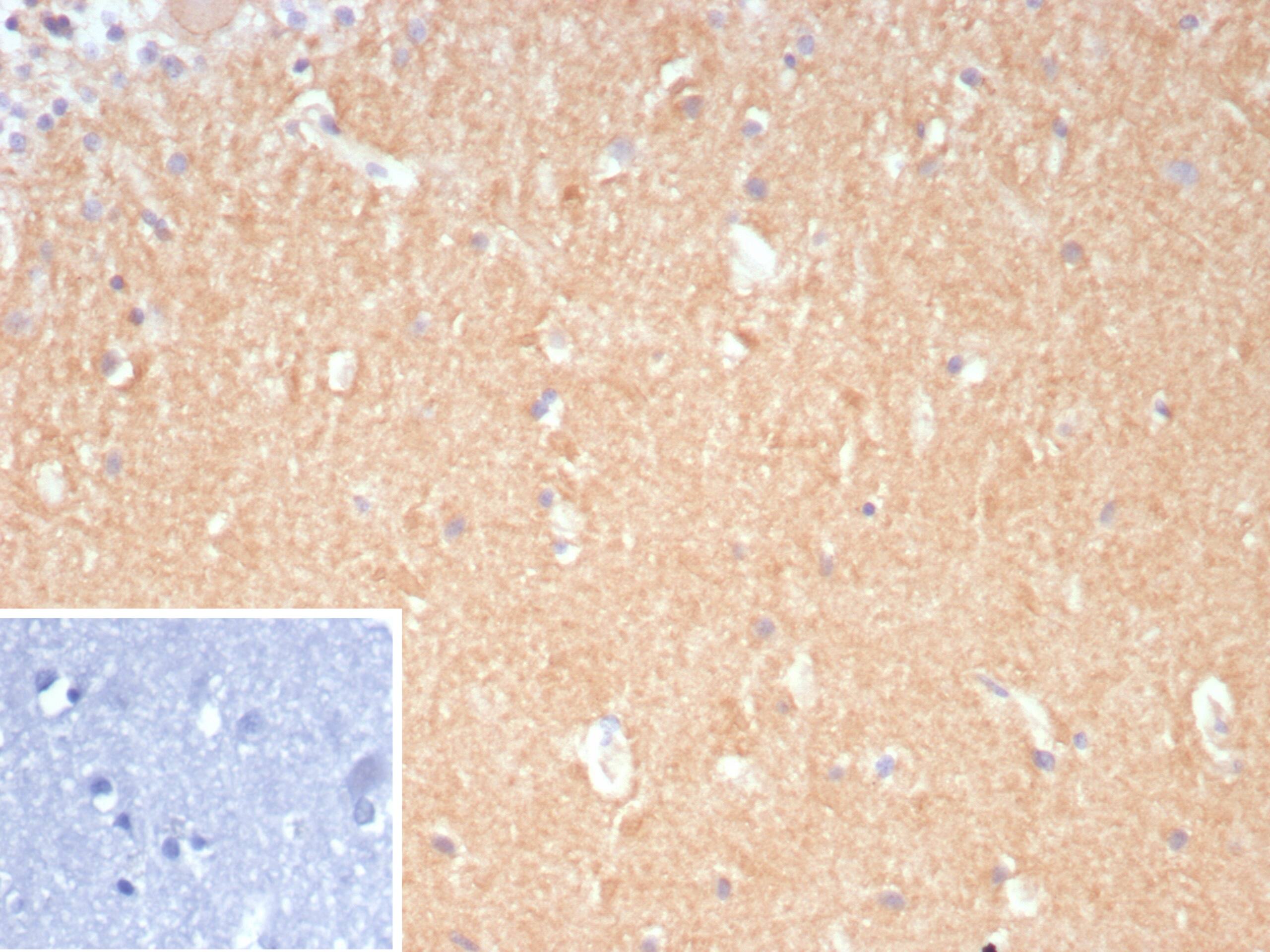 Formalin-fixed, paraffin-embedded human brain stained with DLL3 Antibody (DLL3/9361). Inset: PBS instead of primary antibody; secondary only negative control.