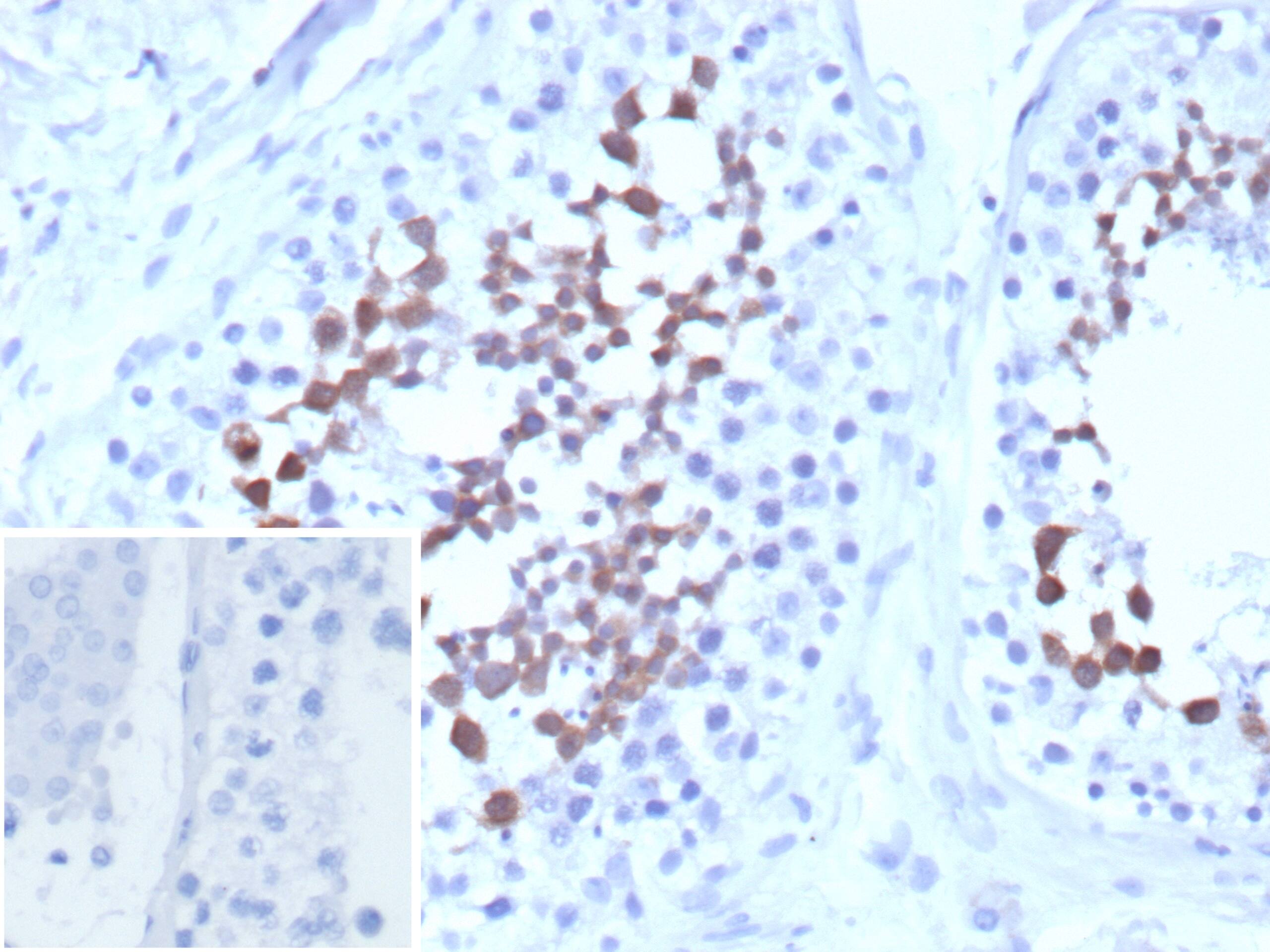 Formalin-fixed, paraffin-embedded human testis stained with Centrin 1 Antibody (CETN1/9878). Inset: PBS instead of primary antibody; secondary only negative control.