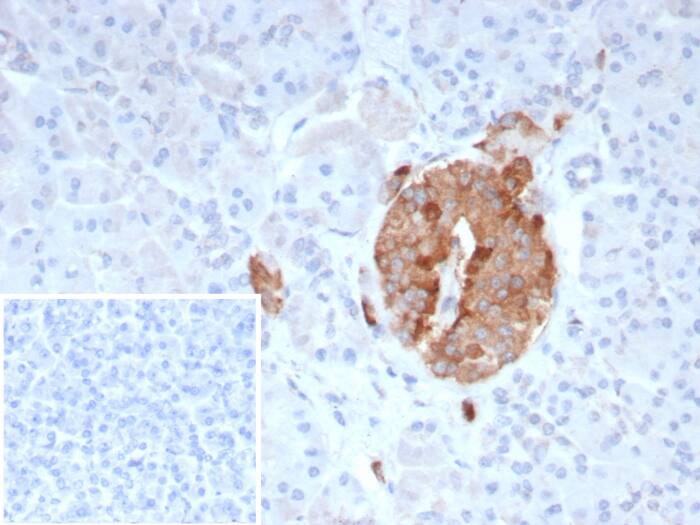 Formalin-fixed, paraffin-embedded human pancreas stained with COL4A3 Antibody (COL4A3/9395R). Inset: PBS instead of primary antibody; secondary only negative control.